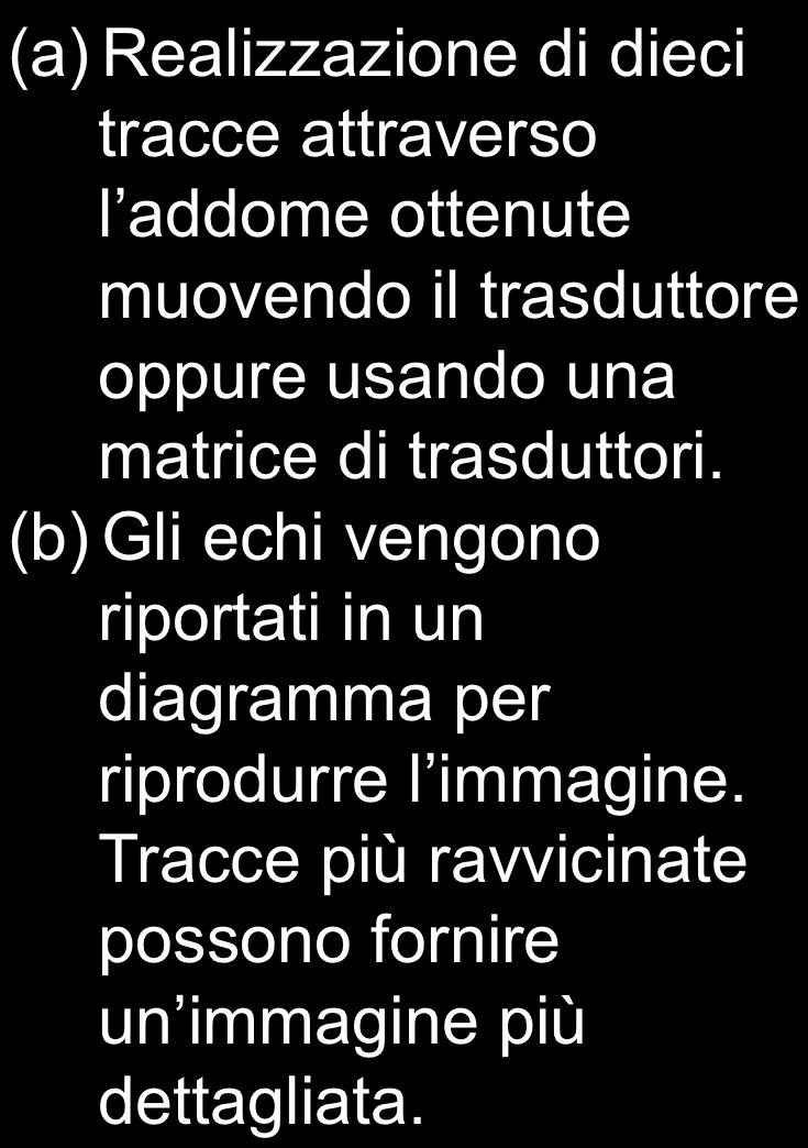 ULTRASUONI (a) Realizzazione di dieci tracce attraverso l addome