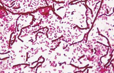 LA MICROSCOPIA - Preparati per Microscopia Batteri e lieviti (12 preparati) 15900 Tartaro - saccharomyces cerevisiae (lievito di birra) - coccobacillo - batteri dello yogurt - acetobacter -