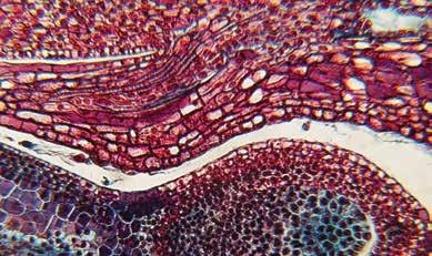 LA MICROSCOPIA - Preparati per Microscopia Studio delle scienze elementari (10 preparati) 15614 Zampa di mosca - piuma di uccello - ala di farfalla con scaglie - striscio di sangue umano - intestino