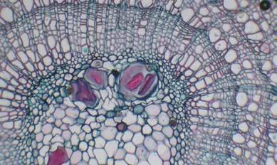 Studio della biologia 1 (10 preparati) 15615 Alga verde filamentosa d acqua dolce con i cloropasti - muffa del pane, con micello e sporangi - girasole, radici in sezione - ligustro, sezione di foglia