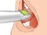 procedura protesica digitale WORKFLOW PROTESICO DIGITALE DENTE SINGOLO CEMENTATO TECNICA CHAIRSIDE impronta ottica intraorale Implant Level* selezione Ti-Base**, progettazione e fresaggio CAD-CAM