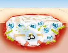 Suprasorb A + Ag Medicazione antimicrobica in alginato di calcio batteri 1 2 3 batteri batteri 1 assorbimento dell essudato in eccesso, che viene trattenuto all interno della medicazione 2