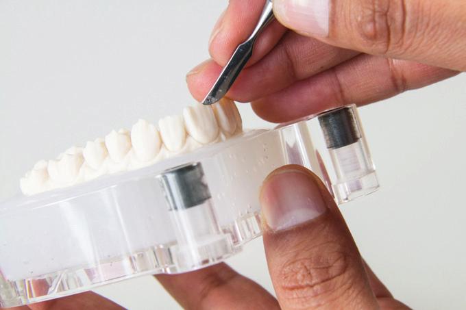 modellazione della dentina.