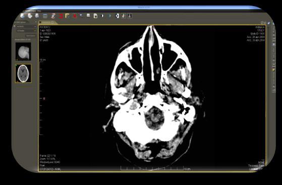 struttura sanitaria e medici curanti Download dello studio e del visualizzatore delle immagini DiCom.