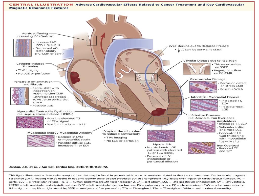 Qualità della Risonanza Magnetica nella valutazione della HF del paziente oncologico Caratterizzazione del tessuto cardiaco: presenta capacità