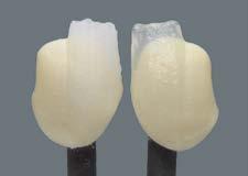 Risultato di cottura / Configurazione della struttura e spessori Nelle ceramiche dentali il risultato della cottura dipende in larga misura dai cicli di cottura individuali dell'utilizzatore.