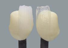 Risultato di cottura Nelle ceramiche dentali il risultato della cottura dipende in larga misura dai cicli di cottura individuali dell'utilizzatore.