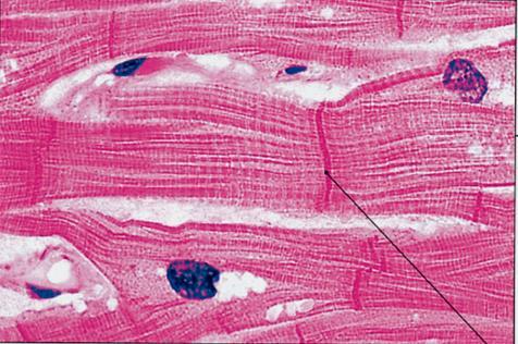 Il citoplasma del cardiomiocito è striato perché le miofibrille contengono sarcomeri.