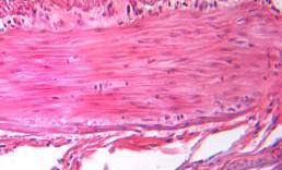 4j. Tessuto muscolare liscio Questo tipo di tessuto è caratterizzato da: 1. cellule indipendenti tra loro e di forma affusolata 2. miofibrille disposte in maniera non regolare 3.