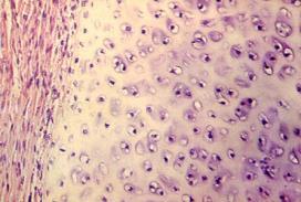 3f. Tessuto cartilagineo La matrice intercellulare è molto densa e gommosa, formata da molte fibre di collagene immerse in una sostanza amorfa gelificata; le cellule (condrociti) sono riunite in