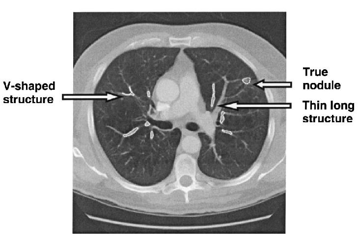 Analisi di CT