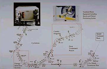 primo modello di ciclotrone Moderno sistema