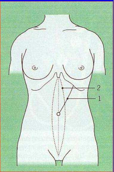 SITI ADDOMINALI SEDE DEL