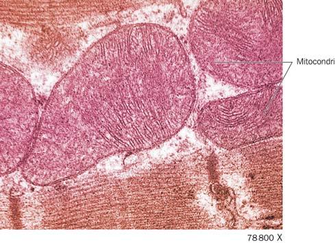 Difetti dei mitocondri possono essere causa di malattie Patologie come la malattia di Parkinson e la malattia di Alzheimer possono essere correlate a