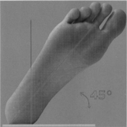 6 4. PROIEZIONI AGGIUNTIVE CAVIGLIA PROIEZIONE OBLIQUA INTERNA (o MORTISE VIEW) INDICAZIONI= studio dell articolazione fibulo-astragalica e tibio-fibulare, per fratture del malleolo peroneale.