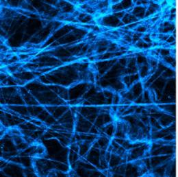 Harmonic generation microscopy