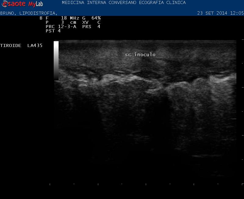 EPIDERMIDE E