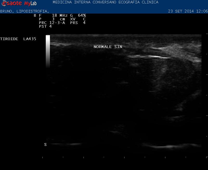 EPIDERMIDE E