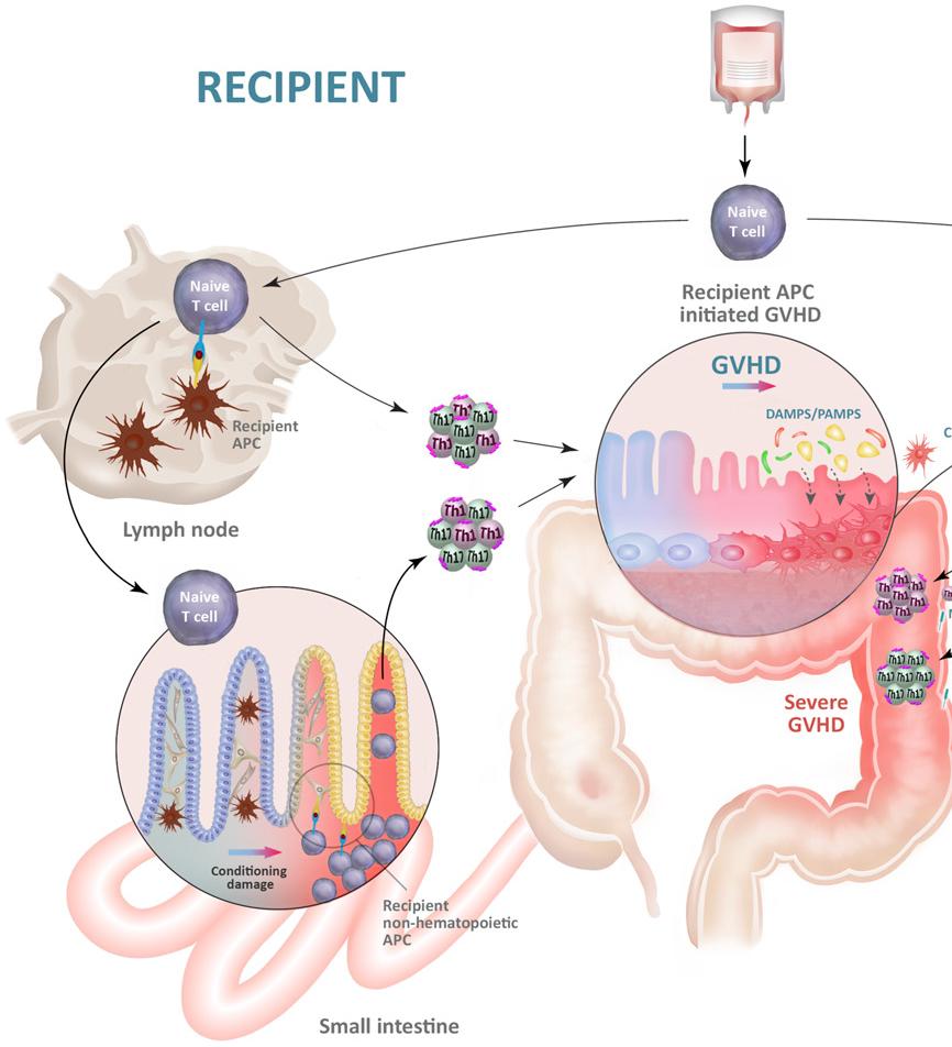 Attivazione delle risposte T CD4+ alloreattive e inizio del GVHD acuto I linfociti T naive che contaminano il trapianto di cellule staminali migrano negli organi linfoidi del ricevente e/o negli