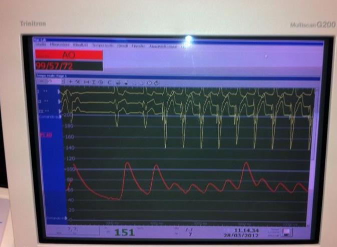 Frequenza cardiaca