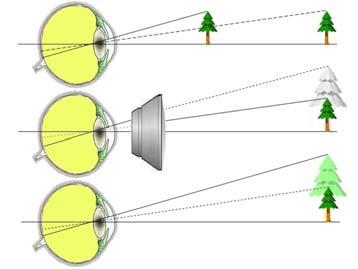 Regolazione Contrasto e Luminosità 6- Possibilità Utilizzo