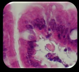 gastrico/intestinale