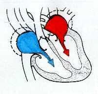 di sangue arterioso 2.