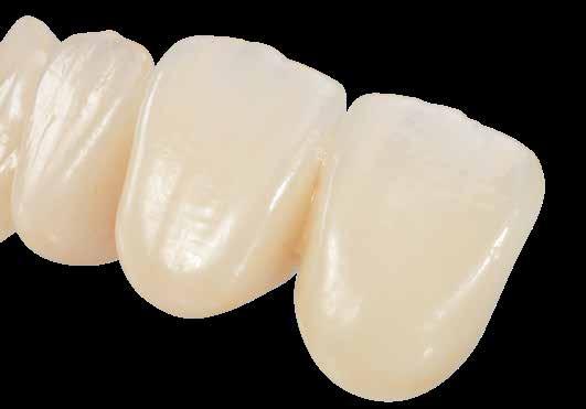 Una nuova era per l ossido di zirconio IPS e.max ZirCAD Prime ridefinisce l ossido di zirconio.