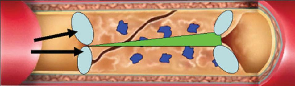 Double approach: WHY?