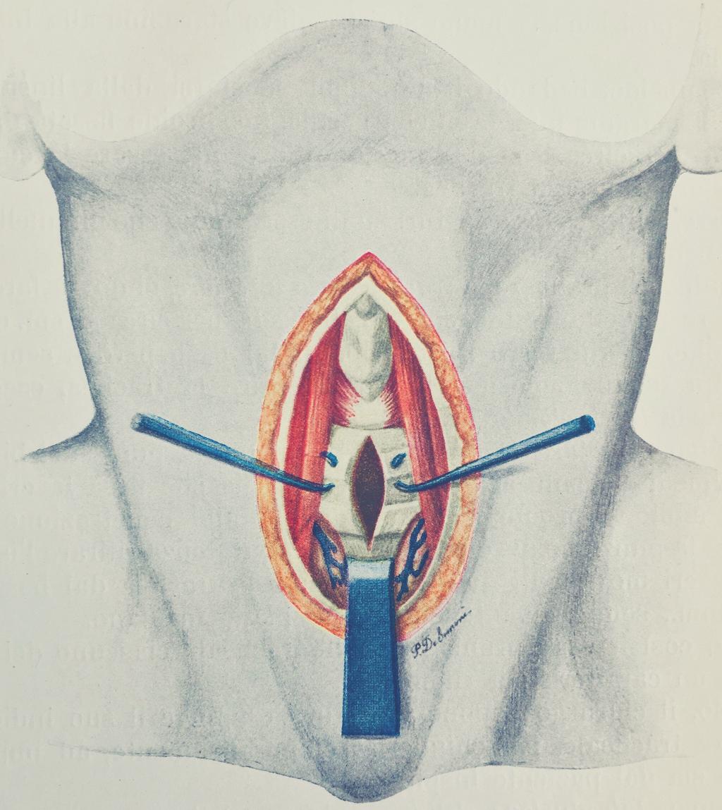 PROGRAMMA CORSO PRATICO - 8 DICEMBRE 2018 08.00 Registrazione dei partecipanti 08.30 Introduzione Prof. R. Puxeddu 09.00 Nozioni di anatomia ovina e strumentario chirurgico Dott. Filippo Carta 09.