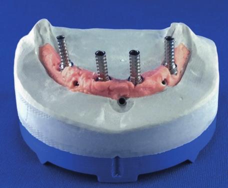 impianti che i manicotti degli anchor-pin previsti per la stabilizzazione della dima in fase