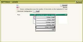 Configurazione elettrodo VS deve essere singola o doppia) Impostare la