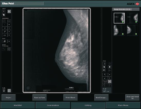 Strumenti specifici per screening mammografico per un flusso di lavoro ottimale L applicazione gamba Full Leg/Full Spine permette di cucire immagini senza punti di giunzione Applicazioni avanzate