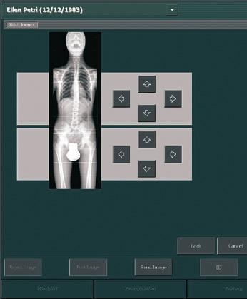 Il sistema di elaborazione di immagini MUSICA² per mammografia garantisce una qualità d immagine coerente ed ottimale.