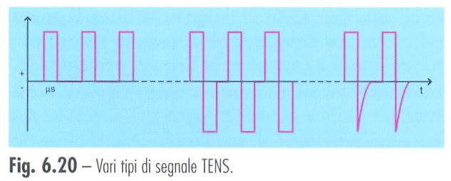 Tens classica: durata impulso: 30-100 microsecondi, frequenza 30-150hz. Analgesia rapida ma di durata incostante.