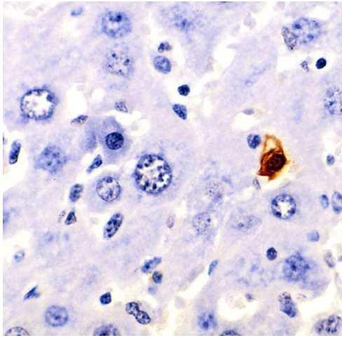 TUNEL histochemical staining in murine liver,