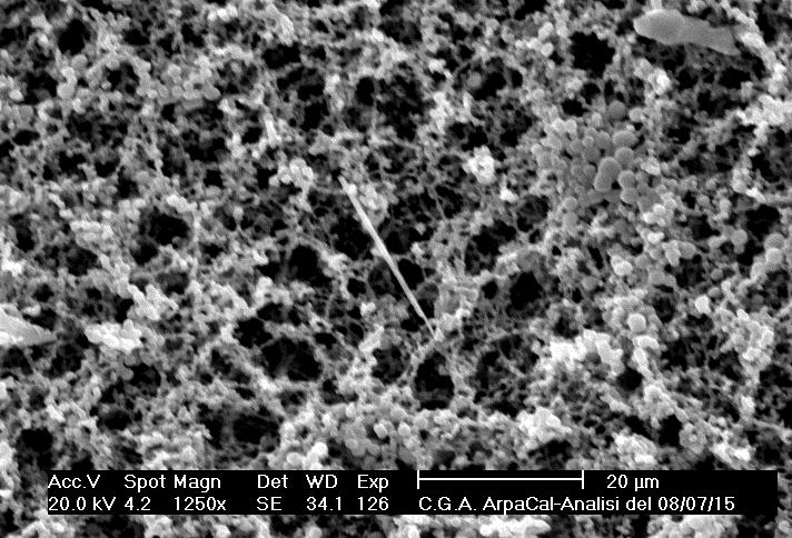 Microscopia Elettronica a Scansione (SEM) e Microanalisi in Dispersione d Energia