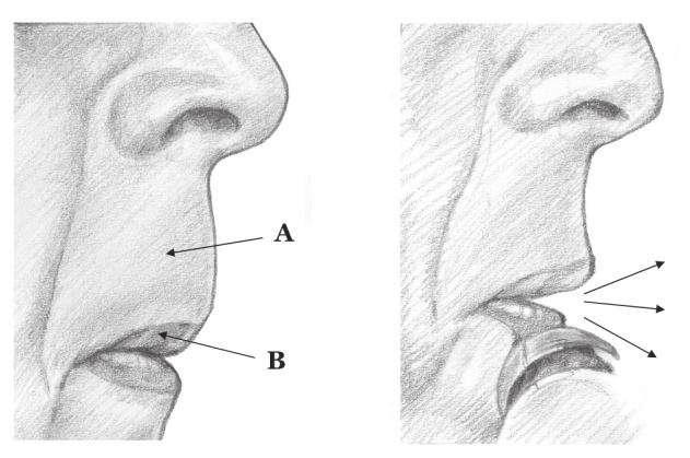 5 Come anticipato, per ottenere un buon suono, le due labbra dovranno avere posizioni differenti anche perché hanno compiti differenti. Analizziamo queste particolarità: Labbro superiore.