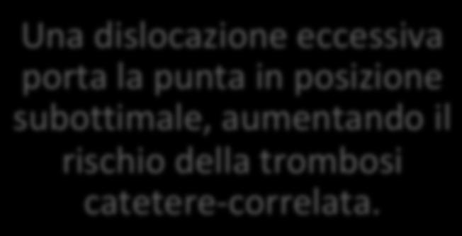 La dislocazione nelle linee guida