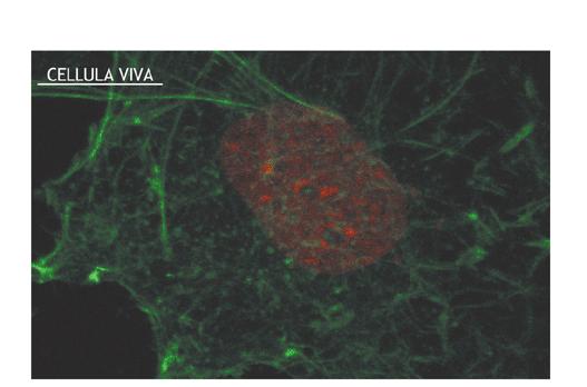 APOPTOSI Necrosi = processo passivo, la cellula subisce un danno, la membrana plasmatica si rompe e il