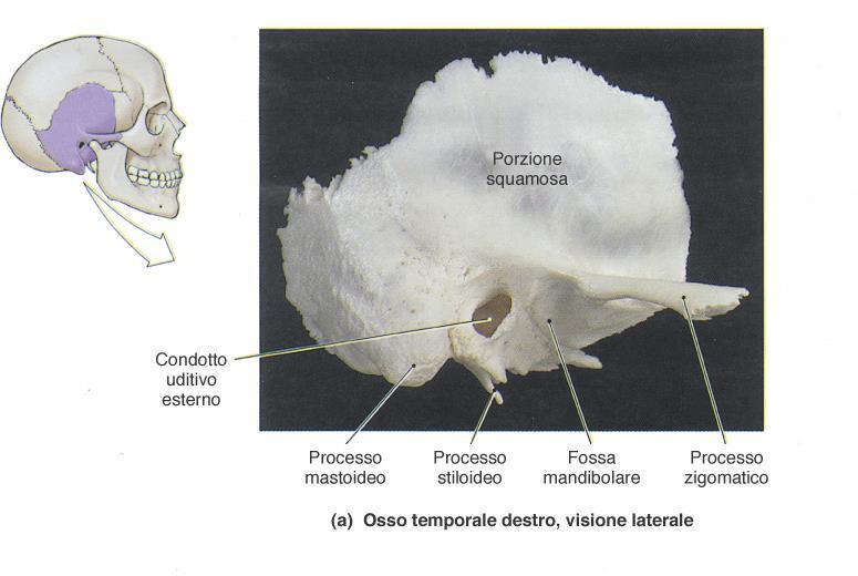 Neurocranio: