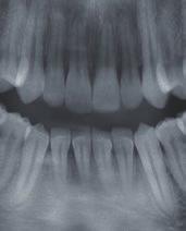 Il risultato è un immagine di una chiarezza sorprendente che consente al dentista di visualizzare senza sforzo le strutture che gli interessano.