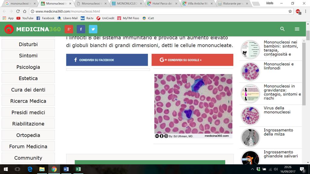 - Linfoadenopatia generalizzata (80% dei casi) colpisce più comunemente i linfonodi latero-cervicali e posteriori del collo, ma può anche coinvolgere quelli ascellari e inguinali.