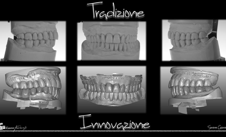 Il Work Flow digitale è oggi un valido aiuto per la realizzazione di manufatti protesici con risultati costanti e predicibili.