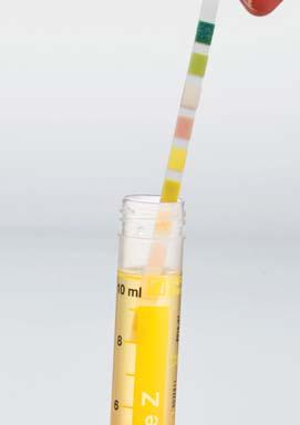 252.00 0 02 / 5 Etichetta in carta 52 Le strisce reattive normalmente reperibili in commercio per l analisi chimica delle urine possono