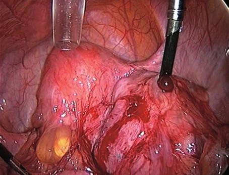 assistita, con l intento di migliorare la fecondità per ciclo (inseminazione, stimolazione ovarica controllata ecc.