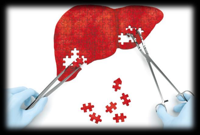 Impatto sull outcome del TRAPIANTO DI FEGATO (LT): Prolungata degenza in TI Prolungata ospedalizzazione Aumentata incidenza di complicanze postoperatorie (infezioni) Ridotta sopravvivenza