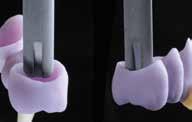 Prima dell applicazione della glasura e delle caratterizzazioni, fissare le faccette, inlays ed onlays su un perno adesivo provvisorio (OptraStick).