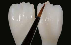 Il cut-back può essere realizzato sia con relativa fresatura nell'unità CAD/CAM (corona dente