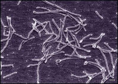 DNA polimerasi di Thermus aquaticus Thermus aquaticus è un batterio termofilo isolato per la prima volta nelle pozze di acqua calda del parco nazionale di Yellowstone, negli (Stati Uniti ).